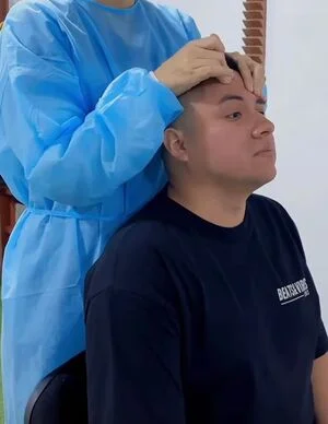fisioterapia para paralisis facial CDMX